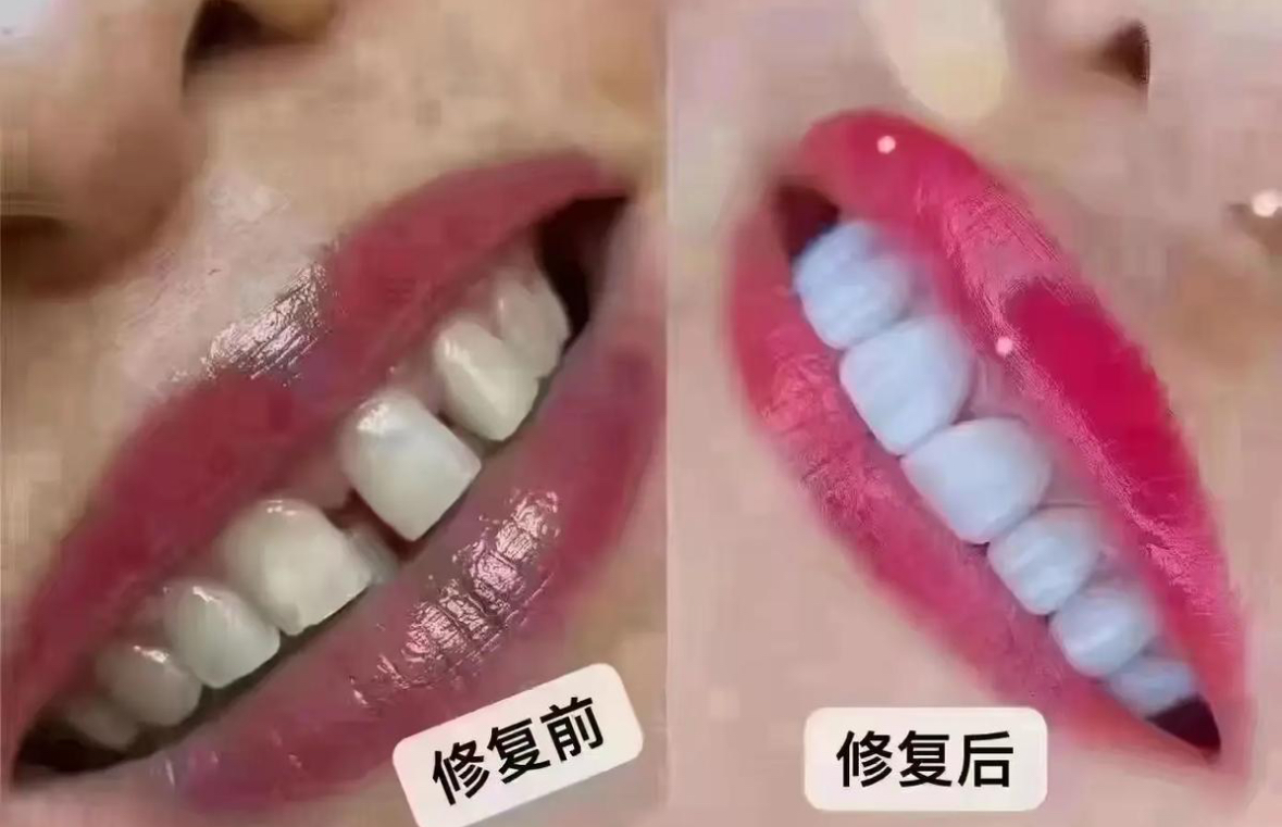 珠海鼎植口腔医院