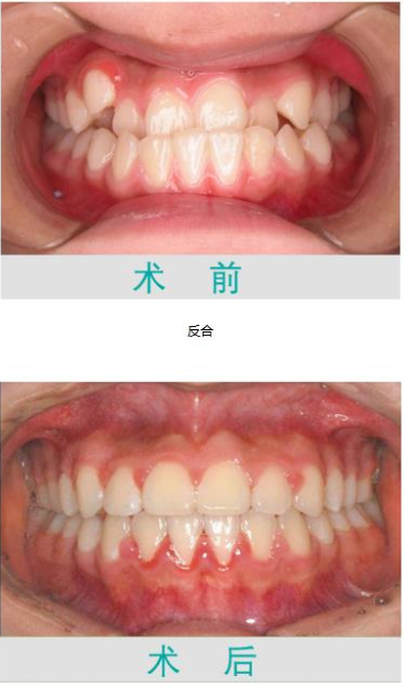 珠海鼎植口腔医院