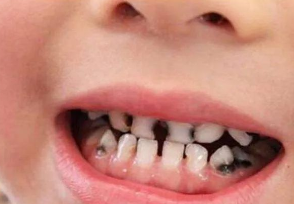 珠海鼎植口腔医院