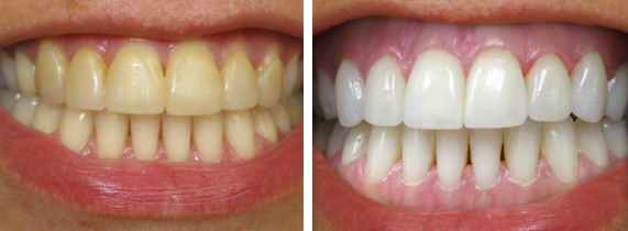 珠海鼎植口腔医院