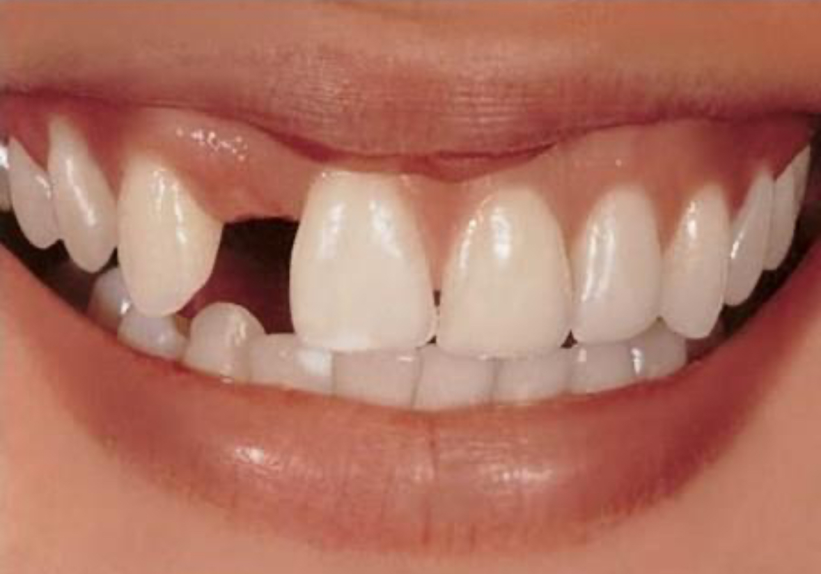 珠海鼎植口腔医院