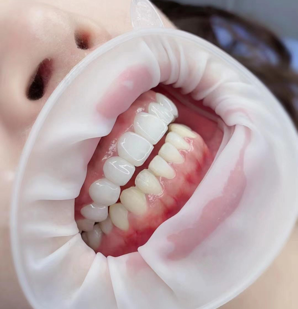 珠海鼎植口腔医院